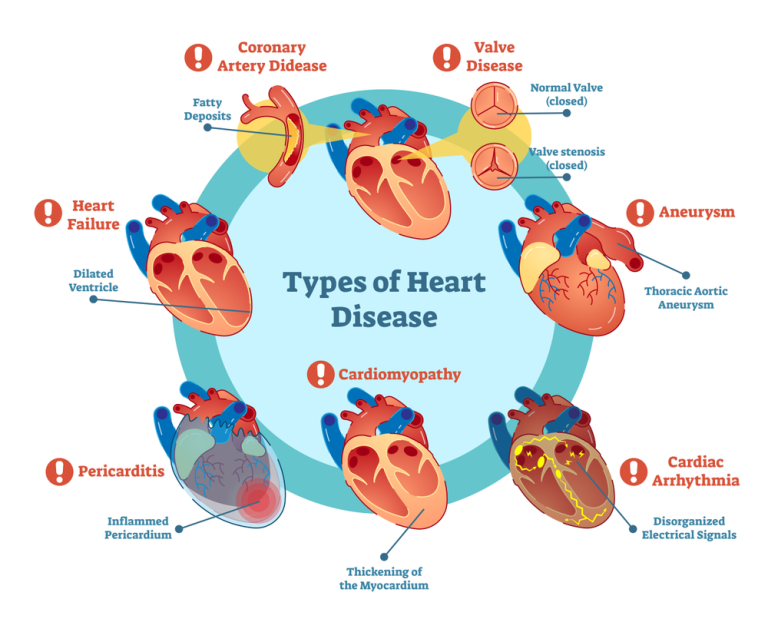 Electrocardiogram (EKG or ECG) Tests: Purpose, Types & Risks
