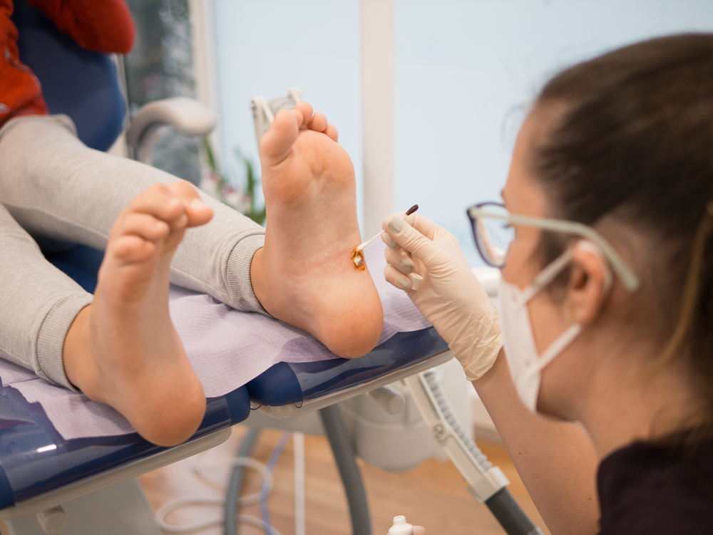 plantar warts